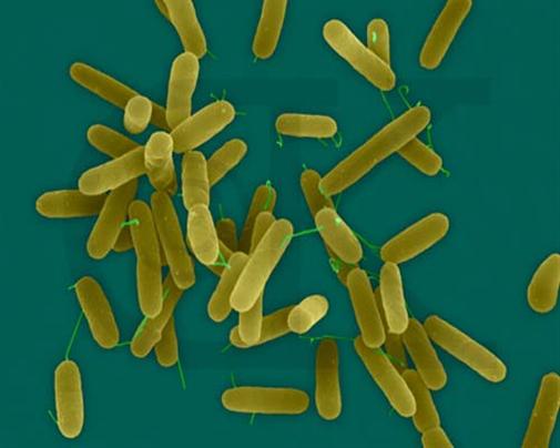 Pseudomonas aeruginosa bacteria